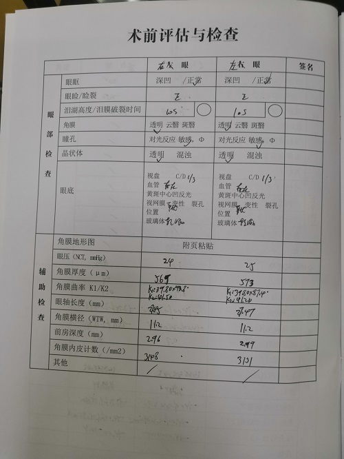 ICL晶体植入分享