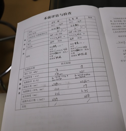 ICL晶体植入术分享